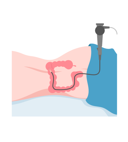 Endoscopy-Colonscopy