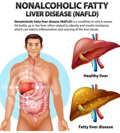 liver disorders